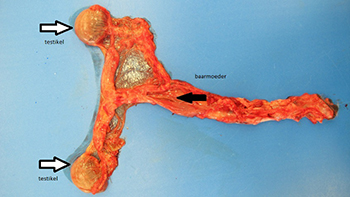 Uterus met testikels