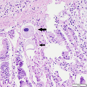 pathologisch onderzoek