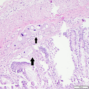 pathologisch onderzoek