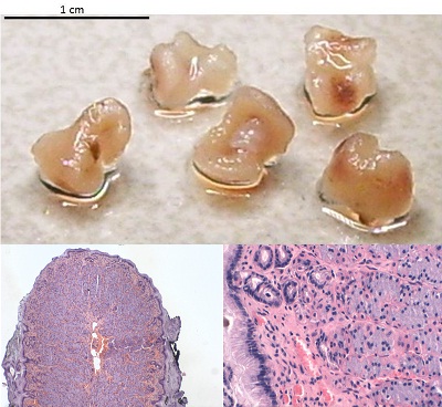 maagfundus