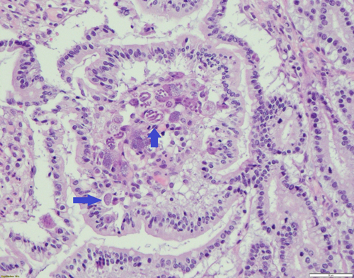 pup met intestinale problemen